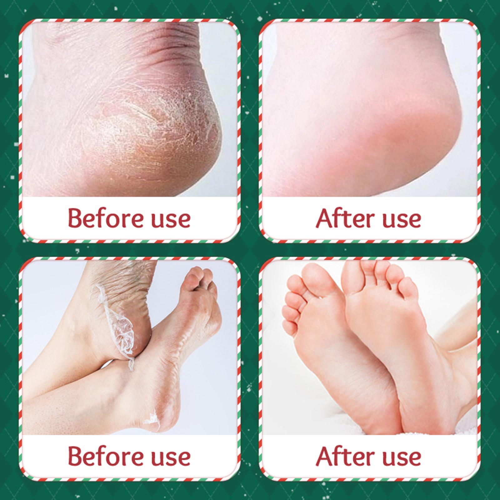 Maschera esfoliante per i pied - Foot Mask Peeling recensione e prezzo